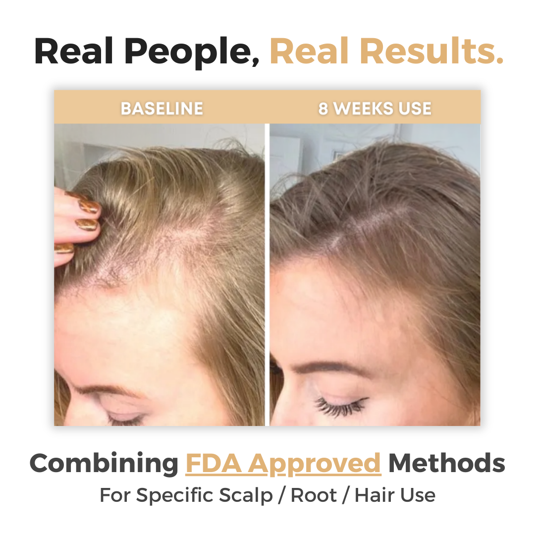 Alments™ HairRevive - Alments