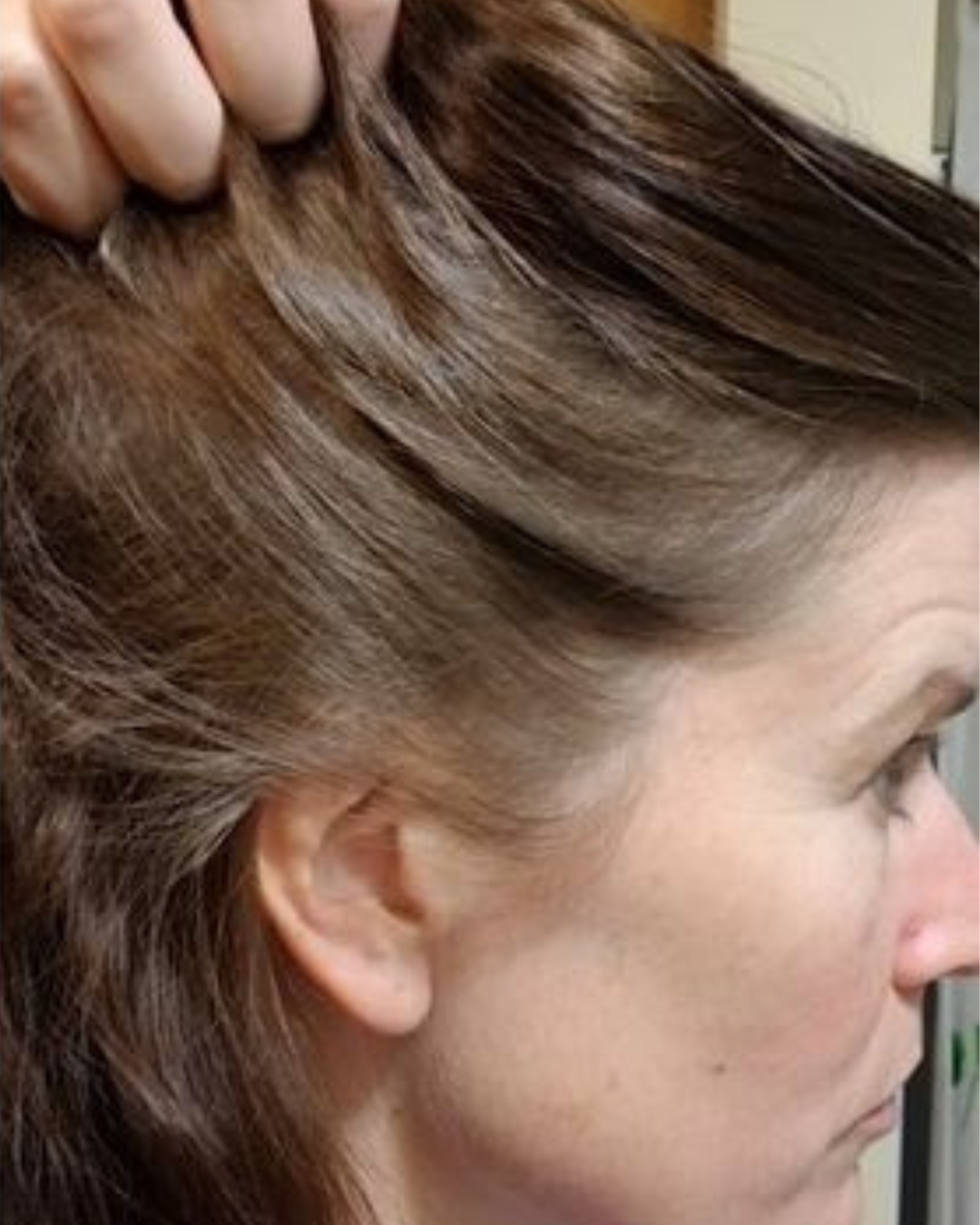 Alments HairRevive 2 483945864230863691 25c88fb1 6a3f 4709 b1fc 5304f93f0990