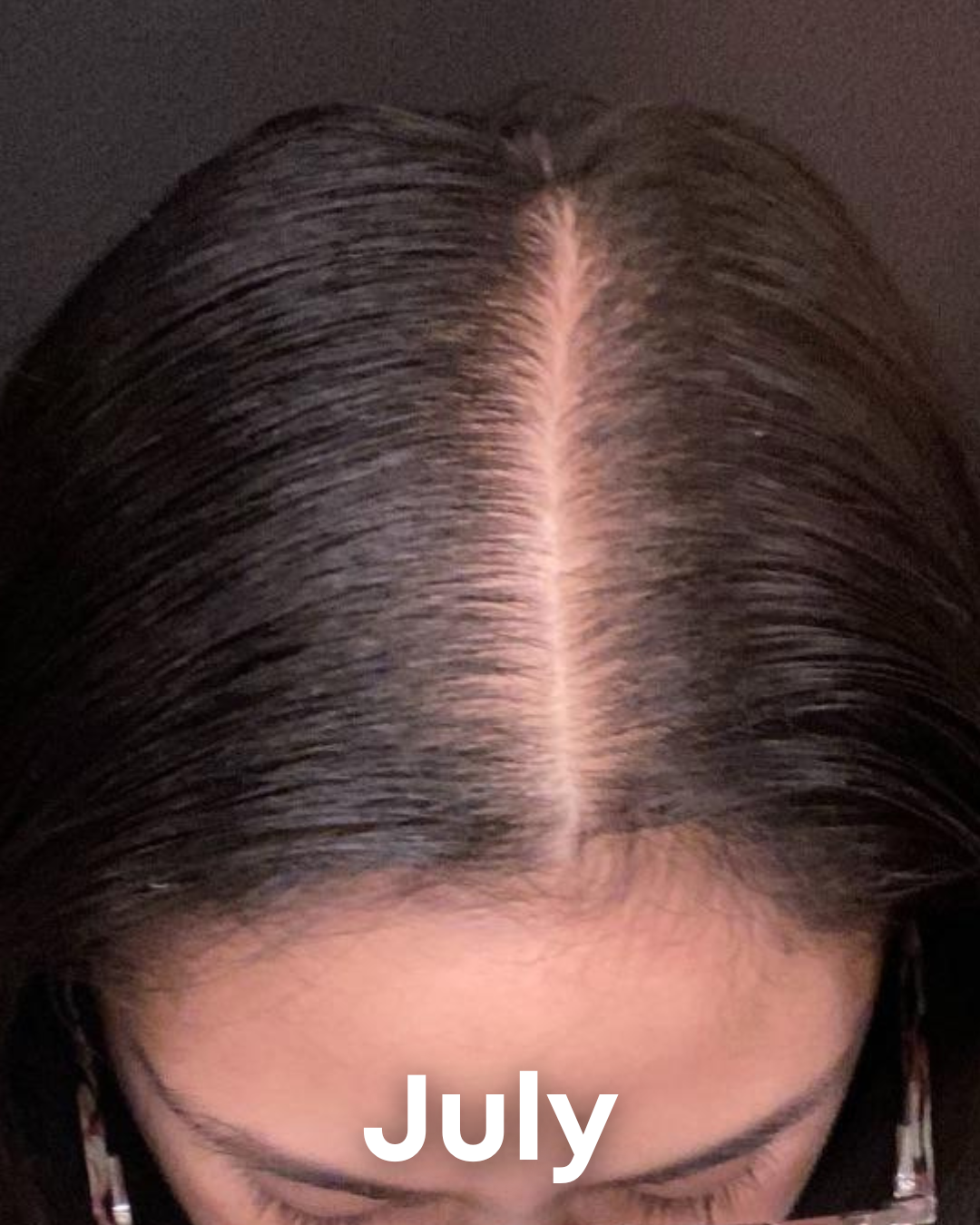 Alments HairRevive 10 483945864230863691 b1c5f277 555c 44ca 9c3e 76b62bba21ef