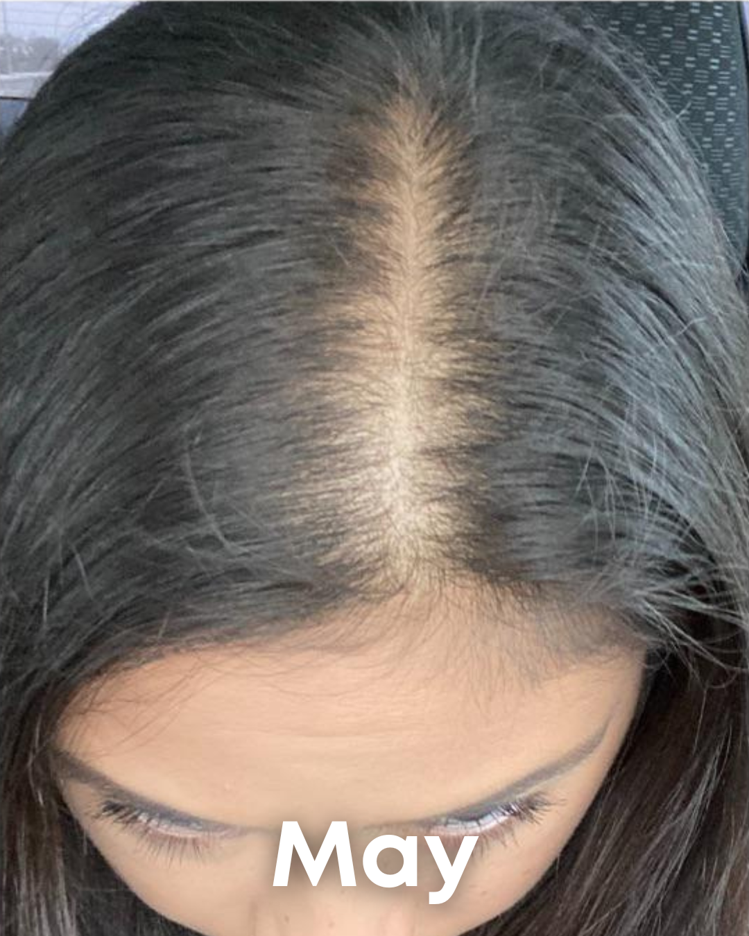 Alments HairRevive 8 483945864230863691 c690534e 49d8 461e 8a89 4ca1ae56a6b5