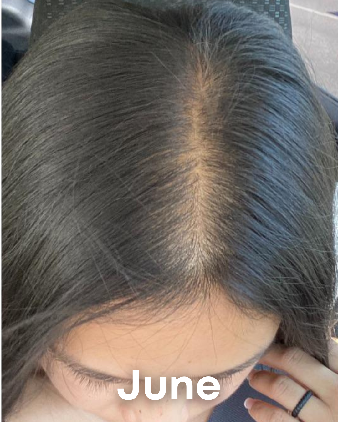 Alments HairRevive 9 483945864230863691 eaf12fed 148a 4c36 82de 5745f9e3d9bf