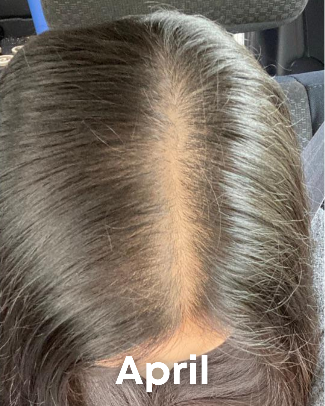 Alments HairRevive 7 483945864230863691 f63a6b70 b882 4a26 a724 ee25720d8d9b